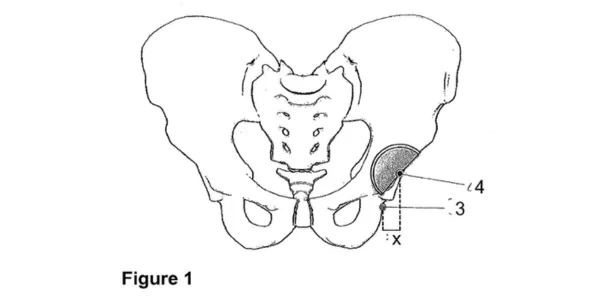 1567420a.jpg